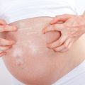 خارش در دوران بارداری