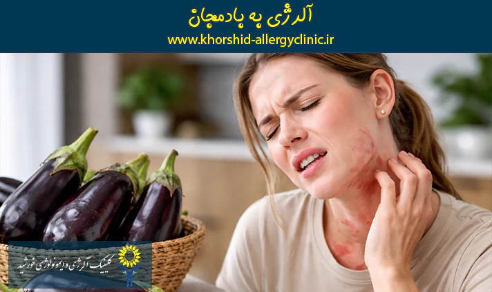 آلرژی به بادمجان
