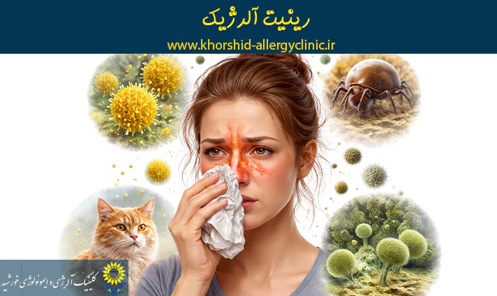 رینیت آلرژیک